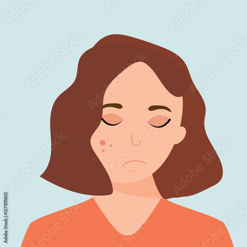 Young girl has skin problems with acne or allergic pimples on her face. Skincare and dermatology concept. Flat style vector illustration.