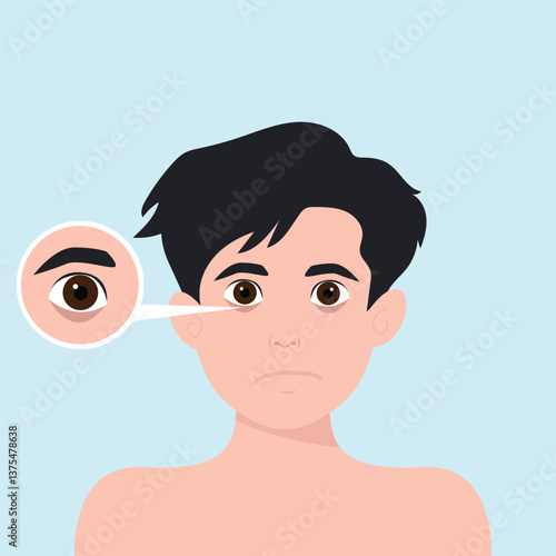 Teenager boy has skin problems with acne or allergic pimples on her face. Skincare and dermatology concept. Flat style vector illustrationv