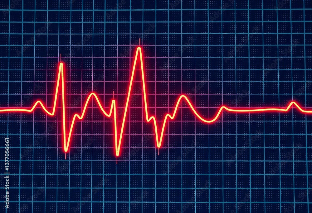 Naklejka premium Close-up of EKG showing irregular heartbeat during a heart attack, ICU, vital signs