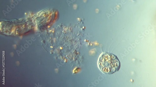 Freshwater eukaryotic microorganisms protozoa rotifer bacteria - 400x magnification DIC microscope