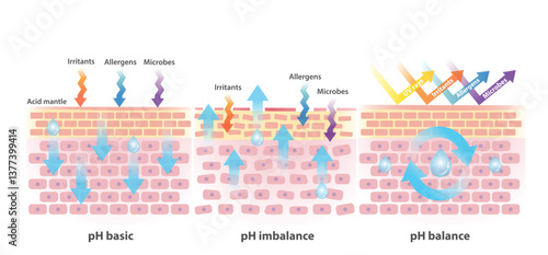 Comparison of skin pH level basic, imbalance and balance illustration. Cross section of skin barrier, the acid mantle protect skin from UV rays, irritants, allergens, microbes and keep moisture in.