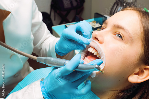 Foto Teenage girl receiving dental cleaning with mouth retractor at clinic by dentist