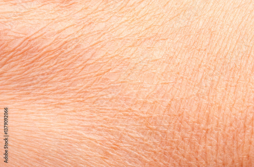 Foto Macro texture of dry human skin, flaky epidermis closeup view, wrinkled body ski