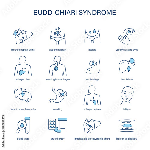 Budd-Chiari Syndrome symptoms, diagnostic and treatment vector icon set. Medical icons.