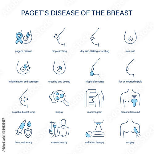 Paget's Disease of the Breast symptoms, diagnostic and treatment vector icons. Medical icons.