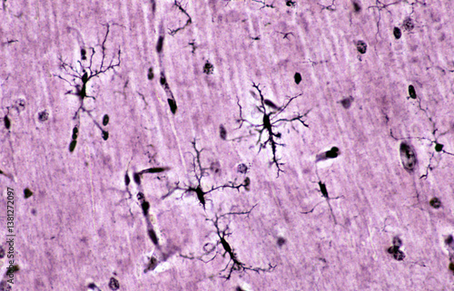 Microglia cells. Rio-Hortega’s silver carbonate