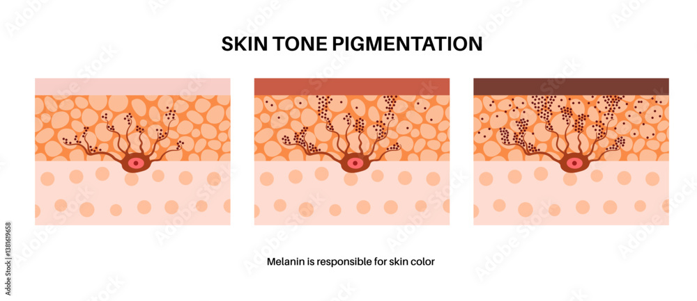 custom made wallpaper toronto digitalMelanin and melanocytes