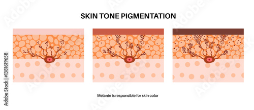 Melanin and melanocytes