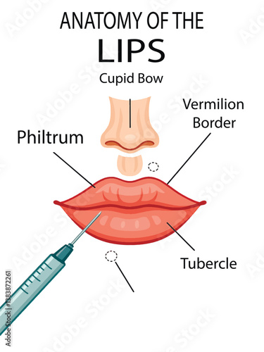 Vector illustration of a cosmetic lip injection in progress. Isolated design on white background. Ideal for beauty and aesthetic visuals.
