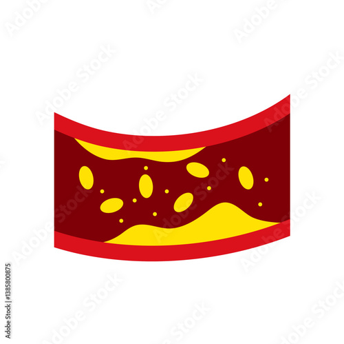 Artery with cholesterol plaque buildup vector illustration 