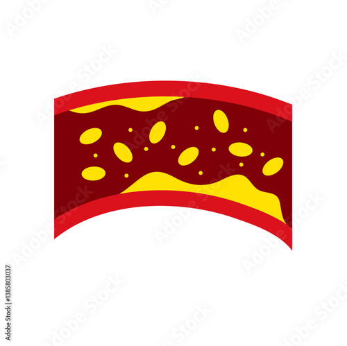 Artery with cholesterol plaque buildup vector illustration 