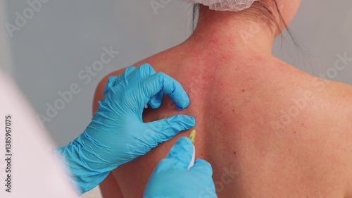 carboxytherapy. hardware injections into the patient's back. beauty and health