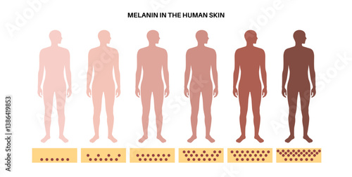 degree of pigmentation from light to dark