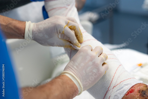 Tableau sur toile Doctors applying bandage on injured leg in operating room