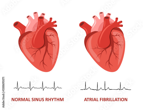 Heart diseases. Normal sinus rhythm and Atrial fibrillation. Medical check up. Vector illustration in flat cartoon style.