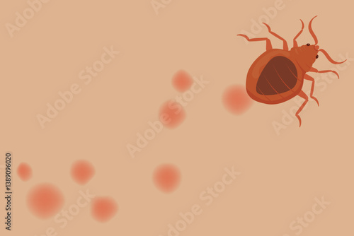 Bed Bug Crawling on Skin Leaving Red Bites Marks