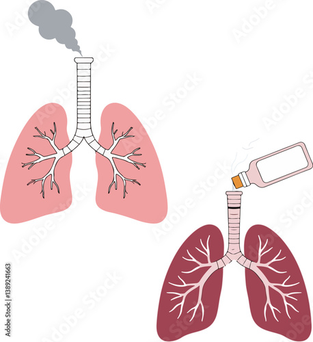 Lung Health Comparison