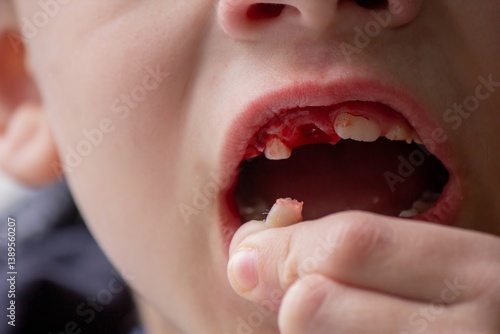 Photos A child has lost a baby tooth. Kid.Concept baby tooth