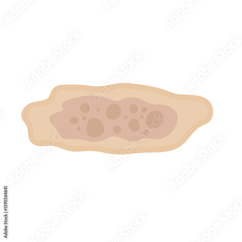 Melasma Skin Pigmentation. Dark Spot Treatment Illustration Design.