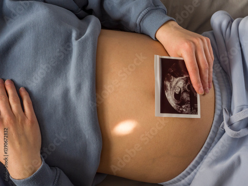 Ultrasound image gently placed on belly as expectant mother rests in peaceful room. Ultrasound image captures tender bond, ultrasound image enhances calm prenatal connection. 
