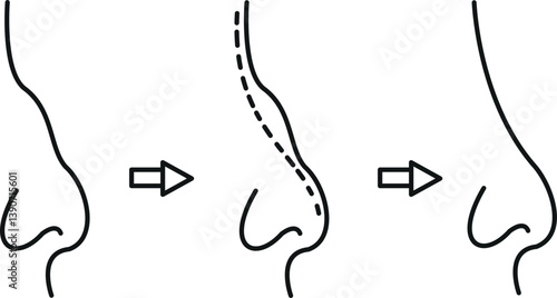 surgery nose icon 