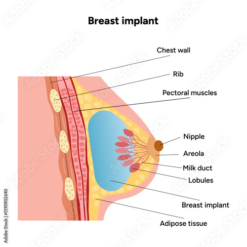 Women’s breast anatomy implant. Medical female diagram