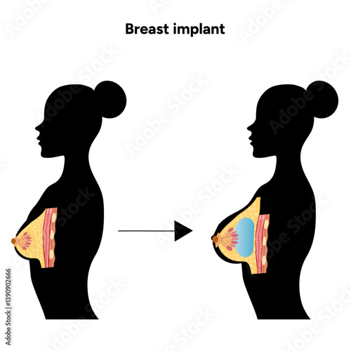 Women’s breast anatomy implant. Medical female diagram