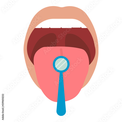 Vector illustration showing an open oropharynx with a protruding tongue holding a dental mirror. Teeth, palate and larynx are visible. The image symbolizes an oral examination.