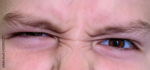 The boy squinted one eye and looked at the camera. Close-up of part of the face