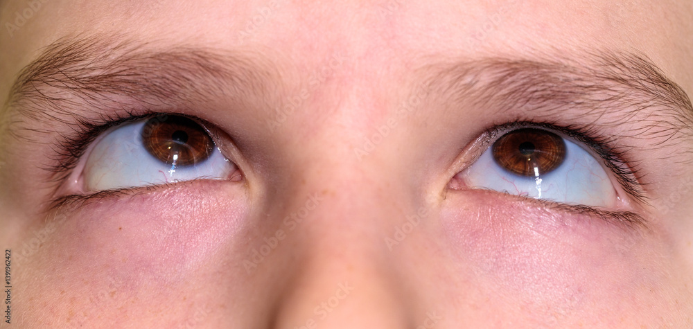 Obraz premium boy with squint looks up with his eyes. close-up of part of face