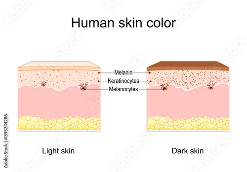 Melanin and skin color. Cross section of a human skin