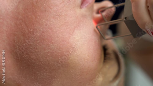 Beautician cosmetologist doing procedure fractional microneedle mesotherapy rejuvenation with laser technology. Hardware cosmetology in clinic salon for client.