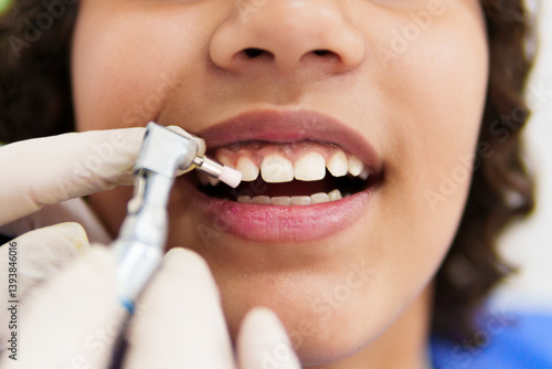Dentist performing teeth polishing procedure on young patient using professional equipment, ensuring oral hygiene and health