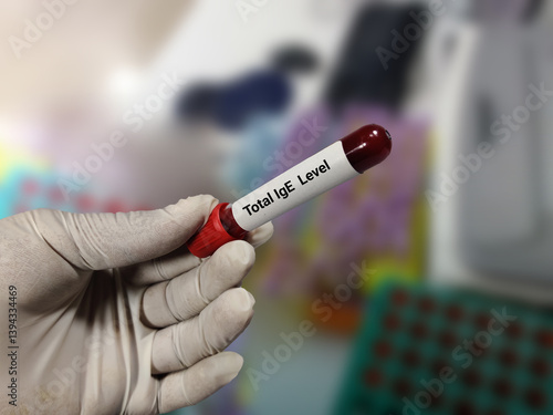 Doctor holds blood samples for Total IgE Level test in the laboratory background.