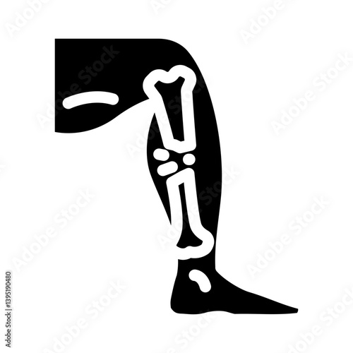 broken leg fracture injury glyph icon vector illustration