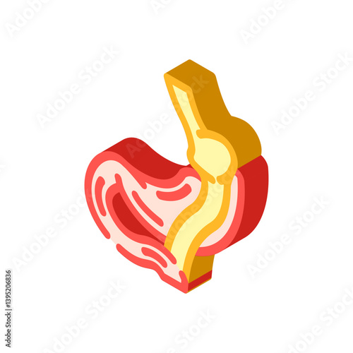 gastric bypass gastroenterologist isometric icon vector illustration