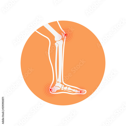 Human leg pain zones. Design elements for infographic.
