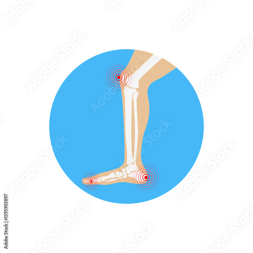 Human leg pain zones. Design elements for infographic.