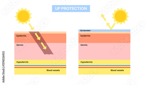 Skin UF protection