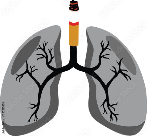 This vector image is an illustration depicting the impact of smoking on human lungs.