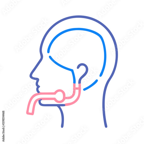  Laryngeal Mask Airway for Ventilation