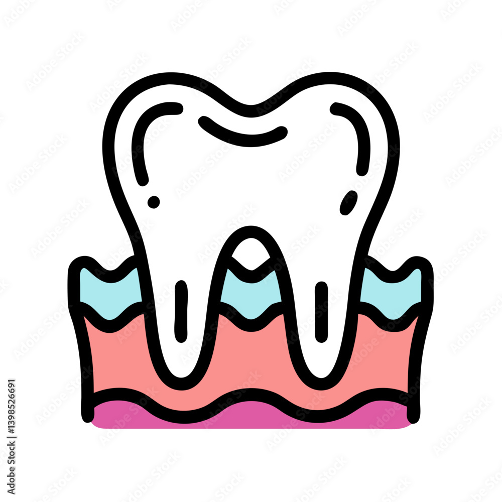 Periodontics Dental Procedure Illustration Periodontics Dental Procedure Illustration