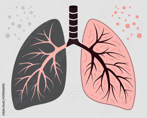 Healthy Lung Versus Smoker's Lung: Visual Comparison of Respiratory Health