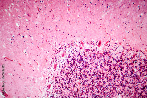 Fotografi Human motor cortex, photomicrograph showing pyramidal neurons in cortical layers responsible for voluntary movement control and motor coordination