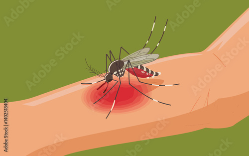 Mosquito biting arm with skin irritation vector illustration concept.