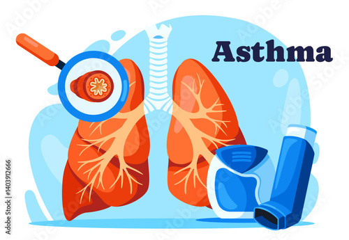 Asthma Disease. Medical banner with anatomical structure of lungs with bronchi compressed due to asthma attack and inhaler with medicine. Treatment and prevention. Cartoon flat vector illustration