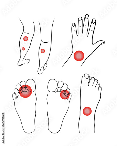 Vector isolated illustration of a set of pain in the arm and leg. Human limb injuries.