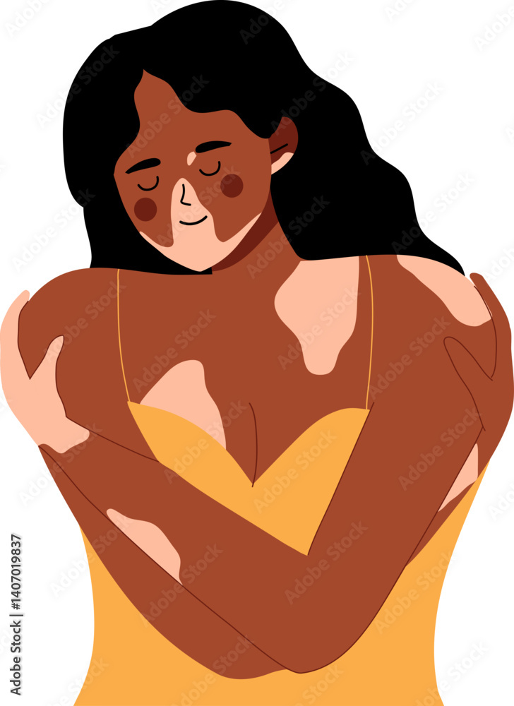 Fototapeta premium woman hugging herself with skin problems. Body positive self love. World vitiligo day.
