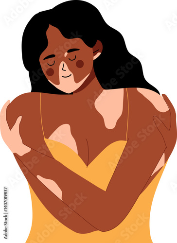 woman hugging herself with skin problems. Body positive self love. World vitiligo day.