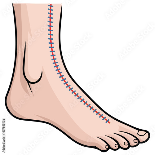 leg wound with surgical thread isolated vector illustration on white background